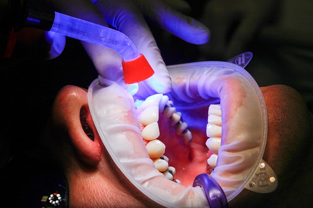 Ljepilo se veže na zub pod UV svjetlom