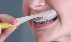 Mekana četkica pranje zubi aparatić 
