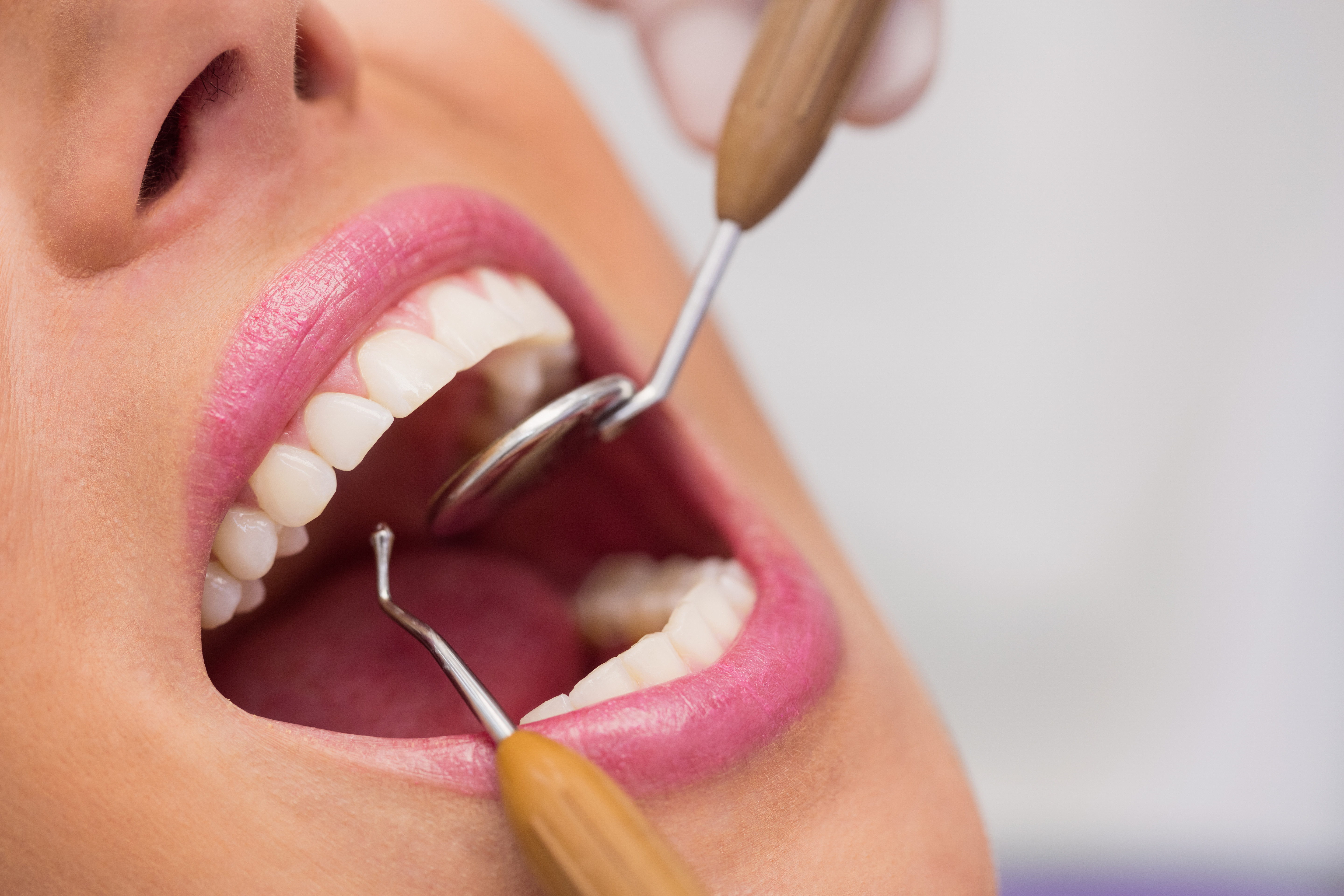 Ugradnja implantata manje je neugodna i bolna od vađenja zuba.