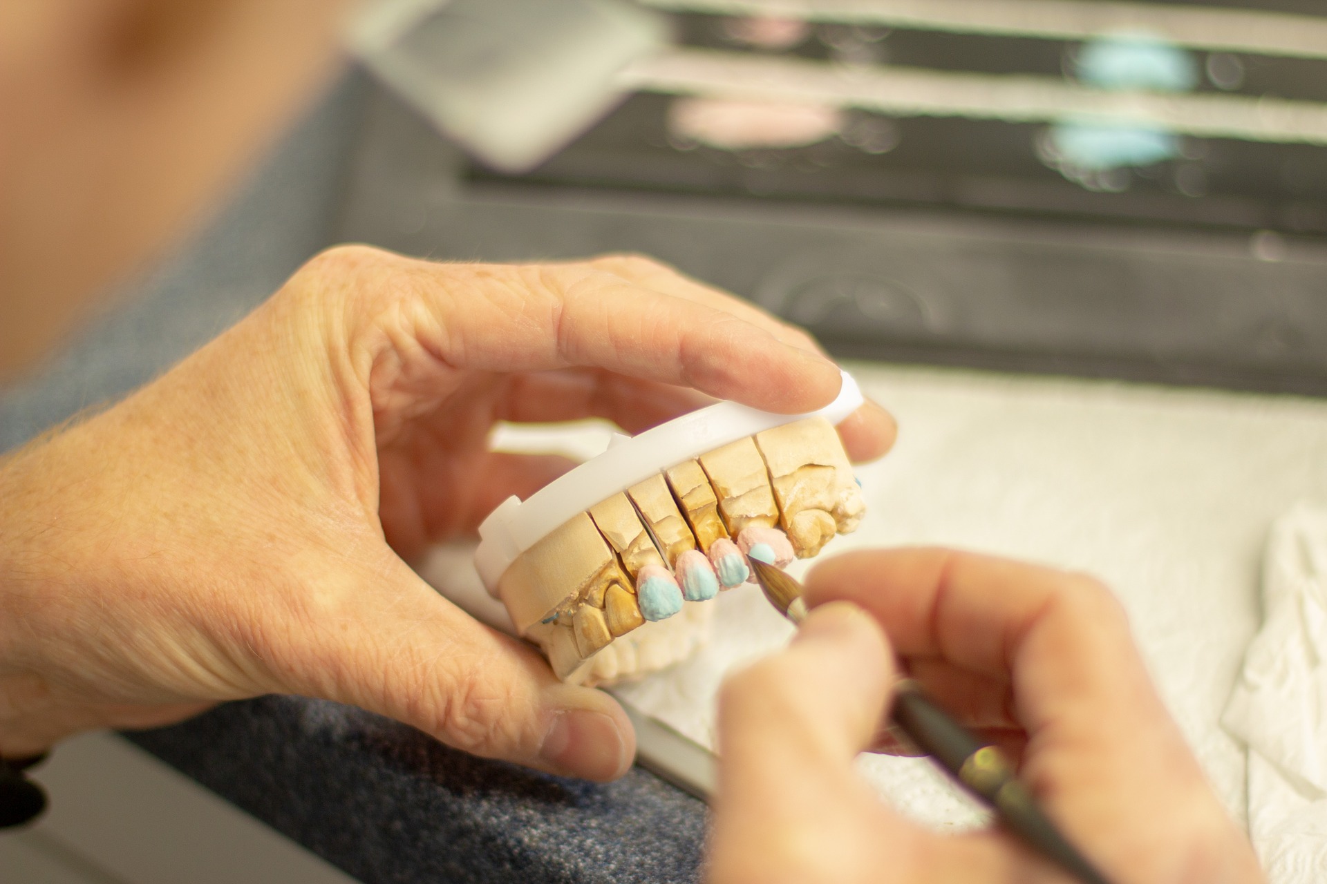 Nanošenje slojeva na zub