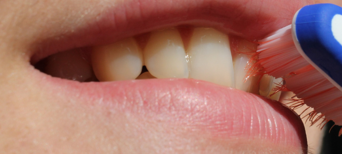 Nakon ugradnje implantata potrebno je održavati pojačanu oralnu higijenu