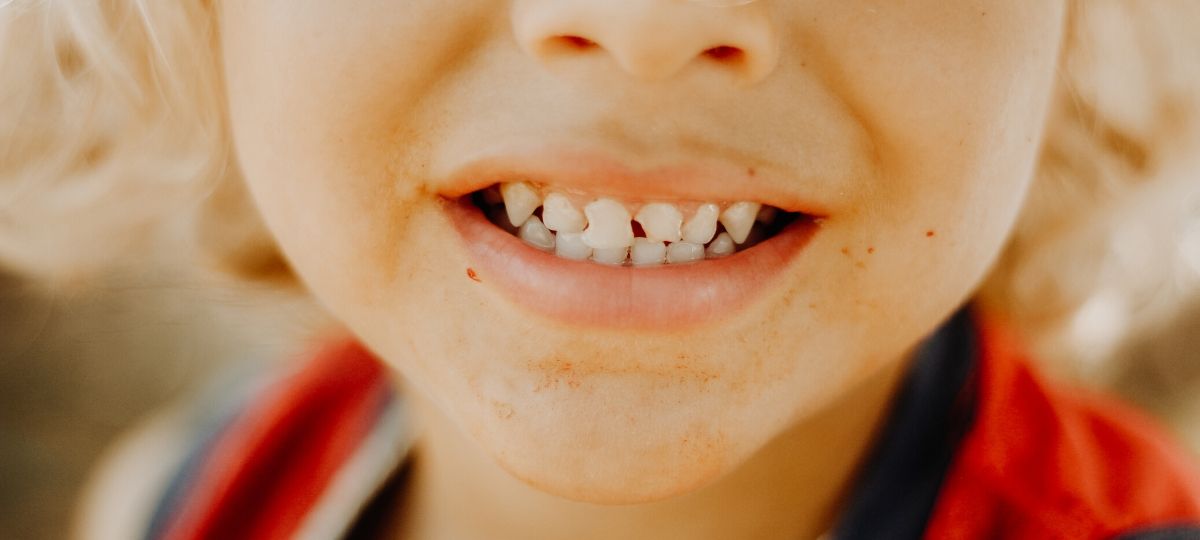 Zubi se mogu početi kvariti od najmlađih dana.