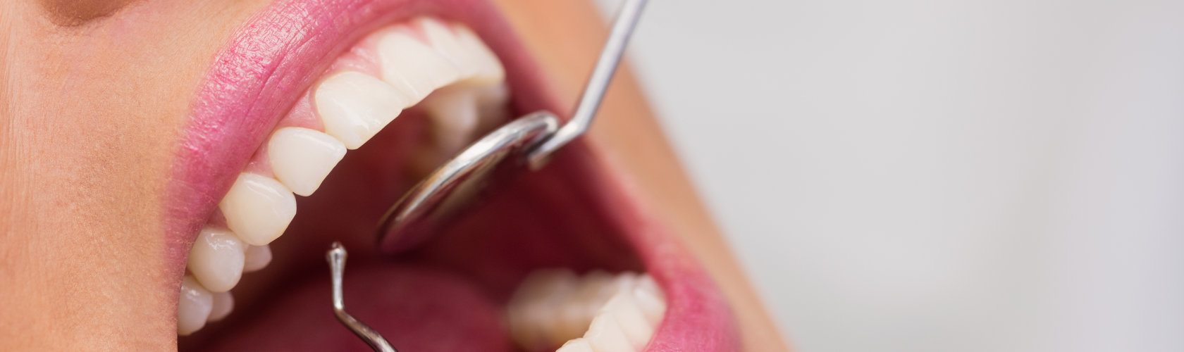 Endodontsko zbrinjavanje zuba