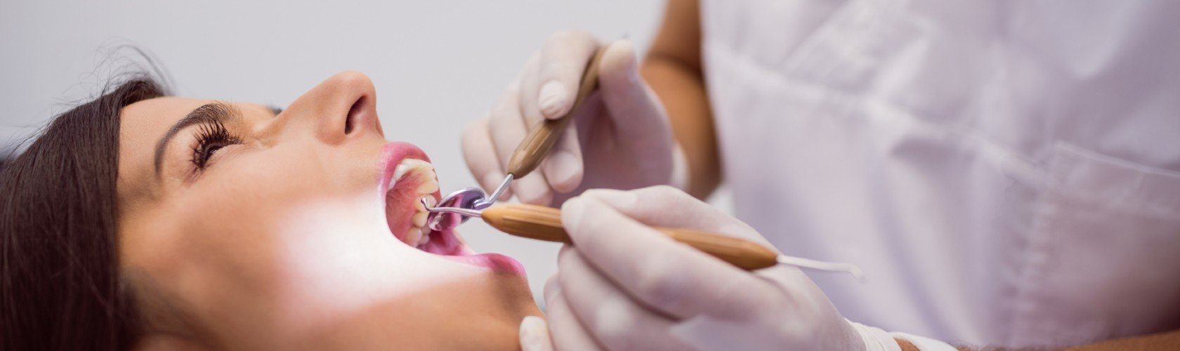 Zubni kamenac skida se kod stomatologa